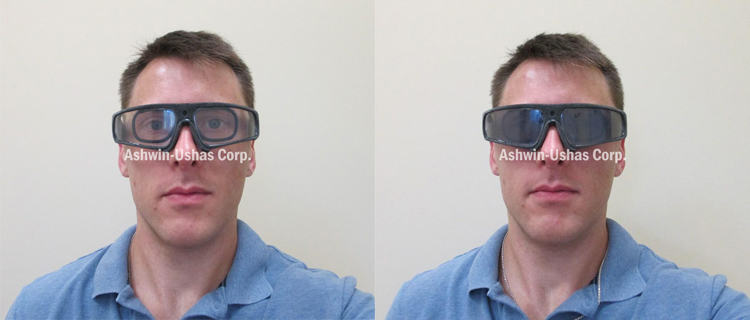 Safety sunglasses prototype with prescription insert: Typical light/dark contrast.
